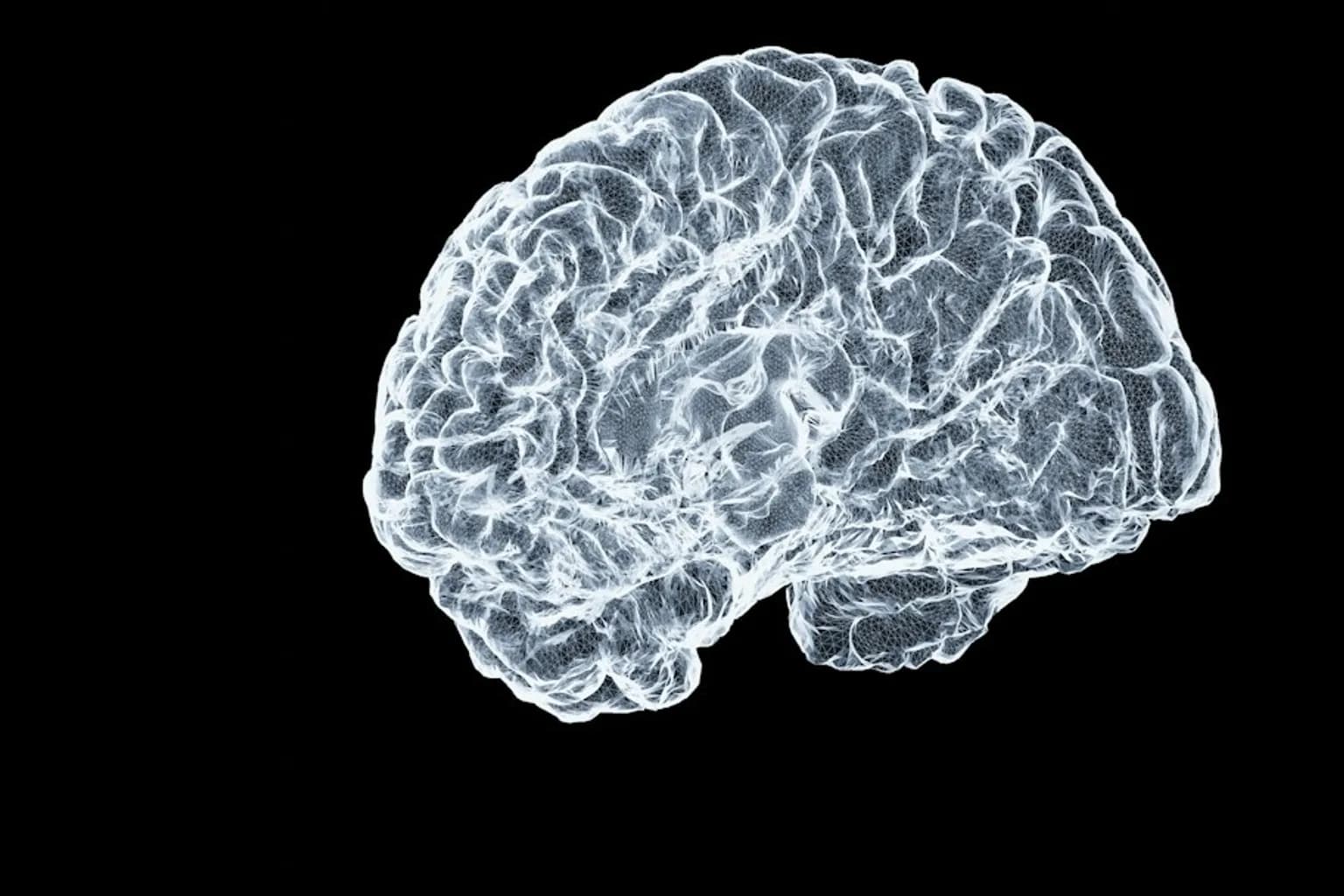 A cross-sectional MRI scan showing the human brain in detail